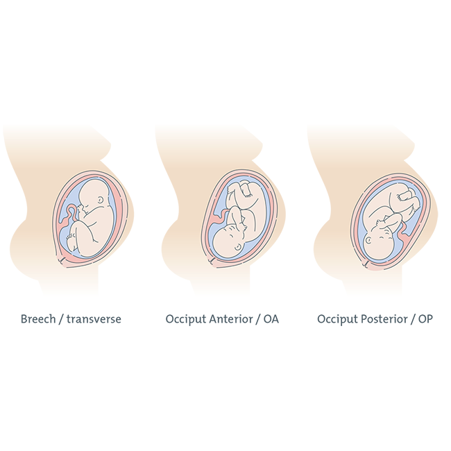 Epworth icons diagrams Leanne Bock