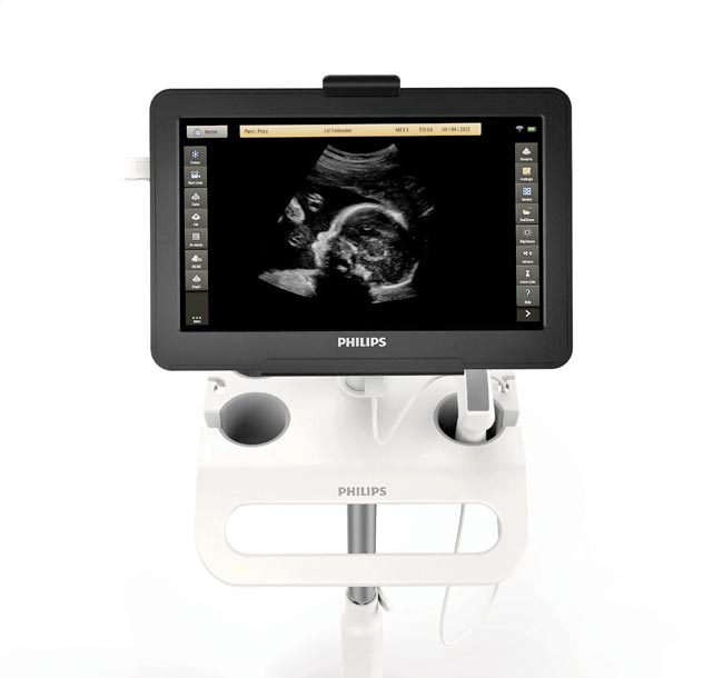 Philips Portable UltraSound Future Health Systems