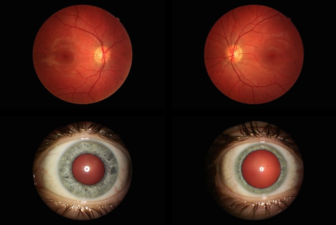 Fragmental Eye Observation - William Fairbrother