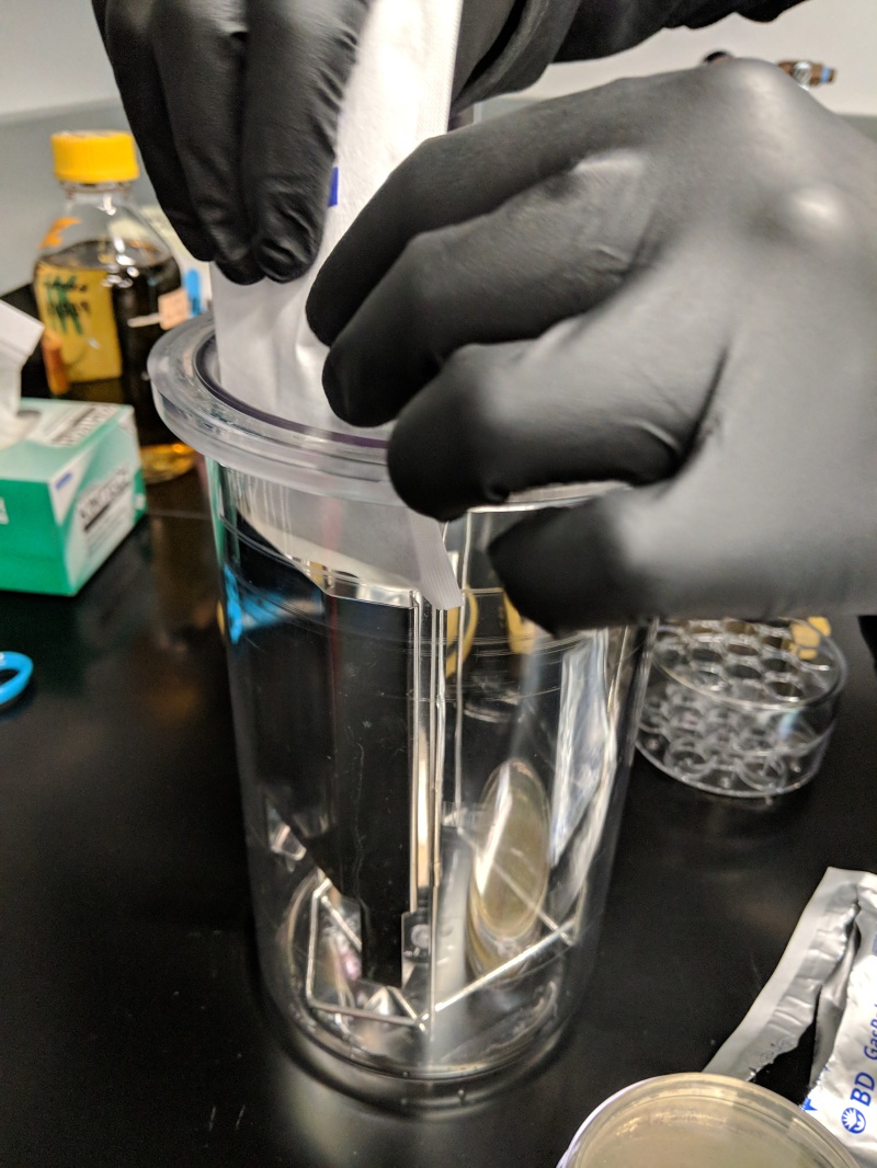 Engineering the Gut Microbiome - New Narratives