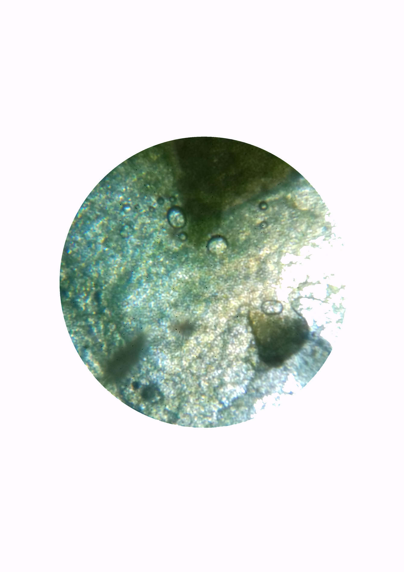 Microscopic Marvel: Is E. Coli Unicellular Or Something More? - heyx1j5