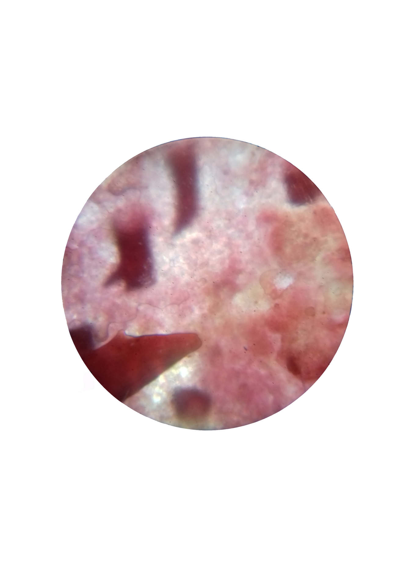 The Microscopic Marvel: Discovering The World'S Tiniest Spider - jveyxz1