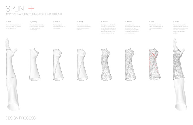 Splint Design Output Splint+ - PeterNguyen