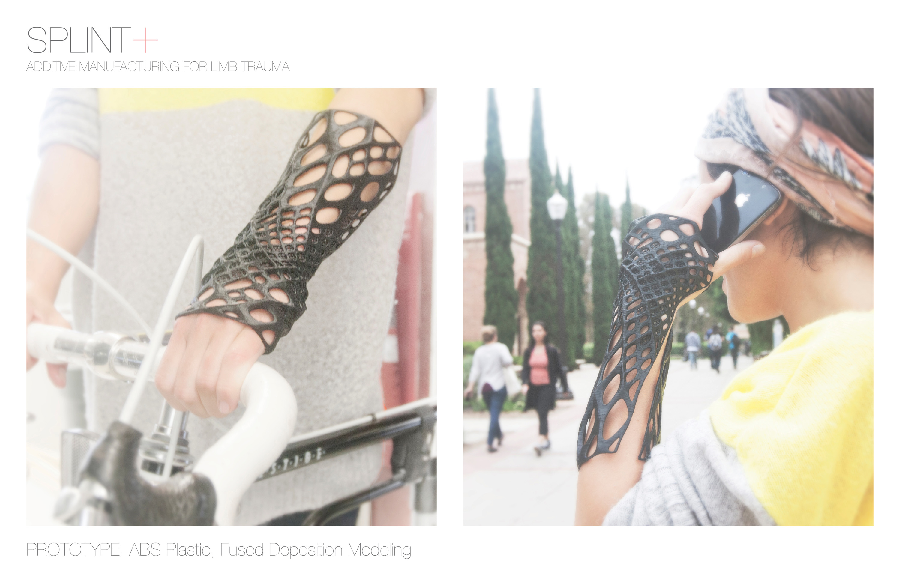 Splint+ - PeterNguyen