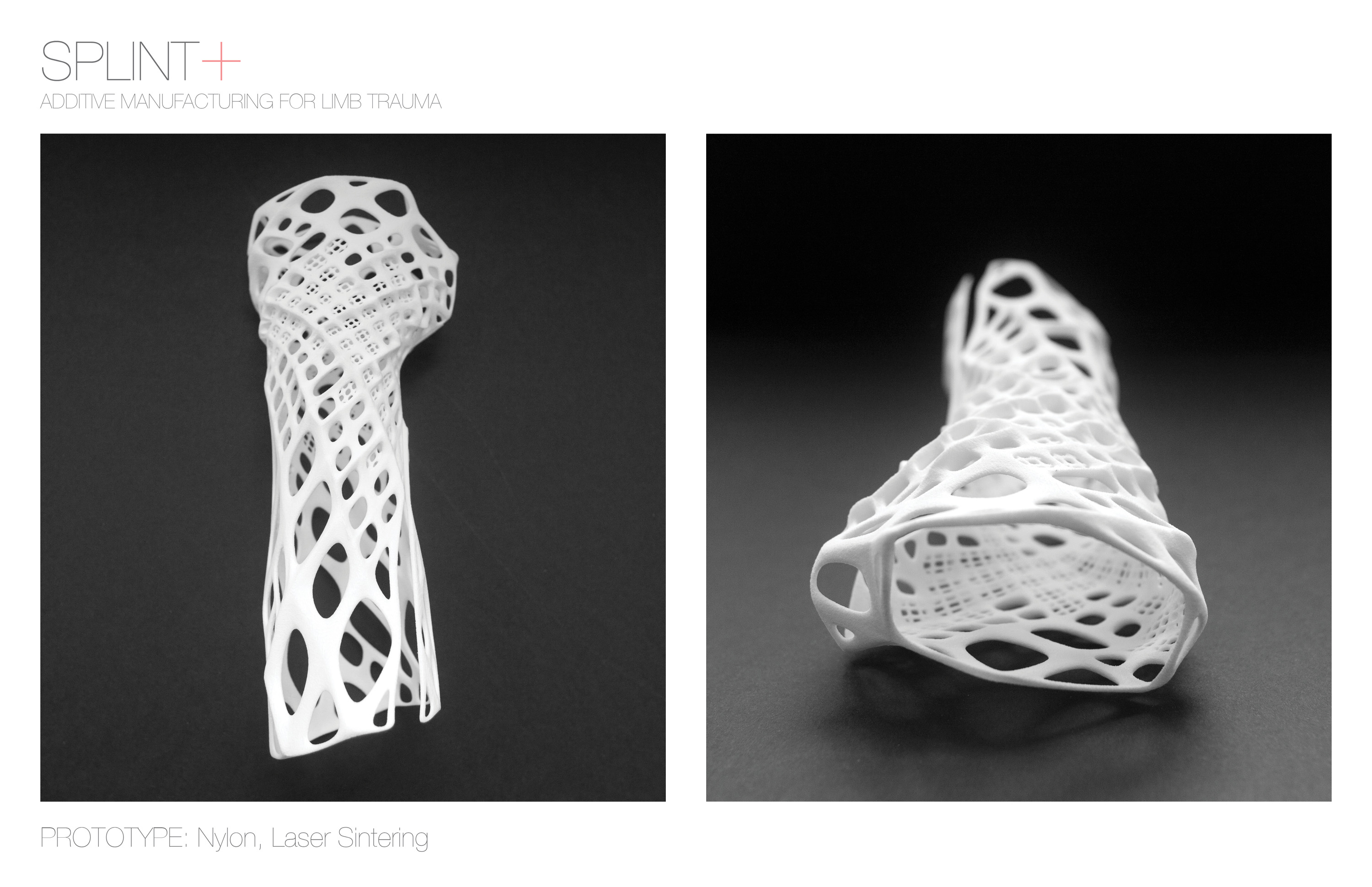 Splint+ - PeterNguyen